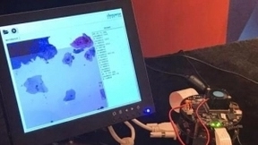 上工医信完成A轮4000万元融资 从AI影像走向服务平台