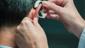 Starkey Hearing 首款 AI 助听器成功发布 明年将全球上市