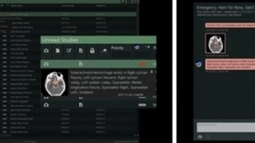 布局人工智能，富士胶片携其医疗AI产品REiLI出展进博会