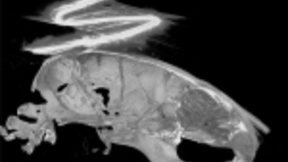 植入大脑的“神经织网”能否帮助人类与人工智能竞争