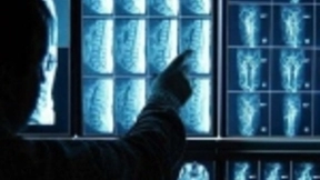 亚诺法携手以色列BioView成功研发整合AI人工智慧之影像分析系统