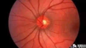 谷歌DeepMind用AI检测50种眼疾，准确率可达94%