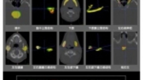 腾讯医疗AI实验室和美国加州大学联合发布最新研究