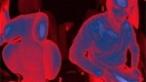 Melexis宣布推出业界首款汽车级单芯片VGA ToF传感器