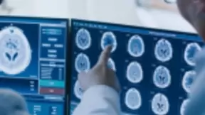 IBM为什么要在医疗保健领域采用人工智能技术