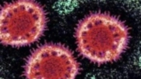 新型冠状病毒对智能手机市场产生冲击，出货量面临下滑