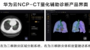 华为云推出新冠肺炎AI辅助诊断服务，疫情期间免费对定点收治医院开放