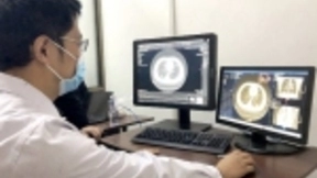 以AI驰援，商汤肺部智能分析产品助力多地科技抗“疫”