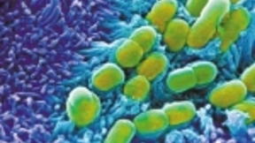 人工智能首次独立发现了一种强大的新型抗生素!