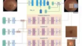 新突破！人工智能模型实现自动精准识别36种视网膜病变
