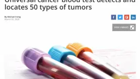 人工智能有望通过分析血液微生物的遗传物质检测50多种癌症
