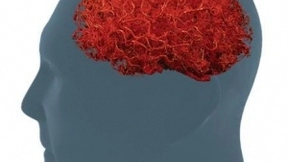 MaxQ AI集成了可检测成像中脑出血的AI软件