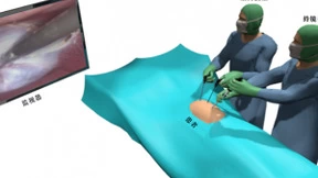 人工智能赋能持镜机器人，微创手术更精准