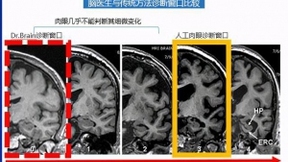 AI医疗热度不减，智能影像的“盘子”到底有多大？