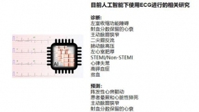 人工智能在心电图中的应用：优势和缺陷并存