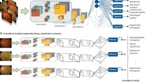 中山眼科中心开发人工智能“ CARE ”　能识别14种眼病，媲美专家