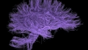 人工智能与神经生理学：为什么差异很重要