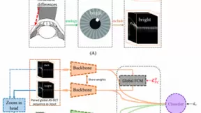 百度智慧医疗携手中山眼科研发3D电子房角镜，成果首登眼科国际顶刊