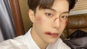 明星体验美图秀秀人像美容全能ACE功能，丰富选择成就一键变美