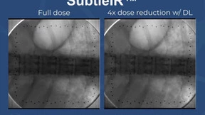 深透医疗全新AI手术介入造影产品获NIH科创基金，完善产品矩阵
