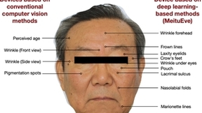 美图公司旗下美图宜肤前瞻布局美业市场，以科技力打破个性化护肤市场“痛点”