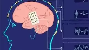 脑虎科技陶虎：脑机接口将成为解决渐冻症的重要手段