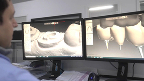 科普长文｜CAD/CAM数字化制造在口腔牙科的应用