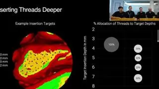 Neuralink脑机接口实验再获突破，微美全息竞争力提升驱动脑机技术飞跃