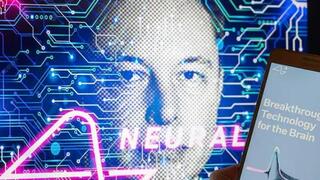 Neuralink全面展现脑机接口技术优势，微美全息多元融合加速创新步伐