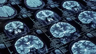 易联众睿图全面接入DeepSeek,开启医疗影像智能化新纪元