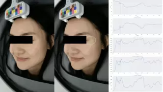 美图宜肤公布动态纹检测技术：抗衰领域的“精准导航系统”