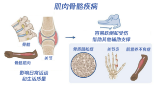 主导起草国家标准，米乔人体工学携手国标院重塑肌肉骨骼健康管理新范式