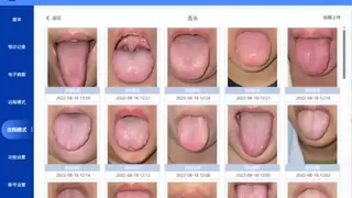 AI中医可视化，把脉是否雷同心电图，看舌头可否归为影像学