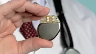 智造“医”线：从精密自动化到AI算法定义，电子制造技术如何为智慧医疗筑基？